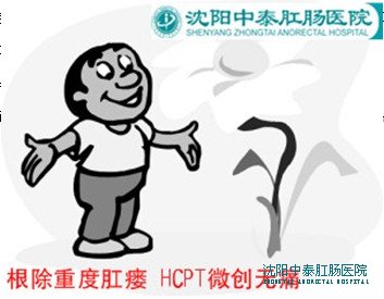 根除重度肛瘘 HCPT微创无痛